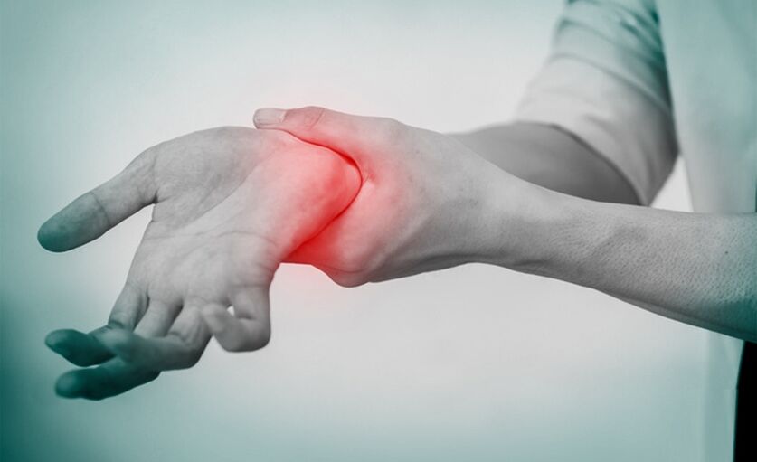 Schmerzen aufgrund einer Arthrose des Handgelenks